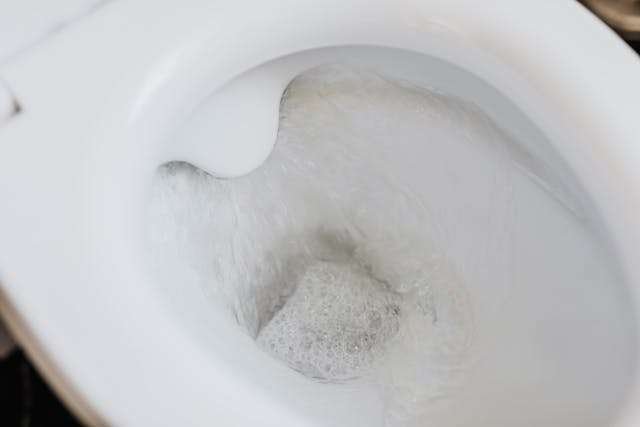 You are currently viewing How to clean toilet bowl stains